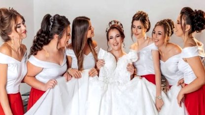 Düğün Öncesi Estetik Kabusa Dönüşmesin